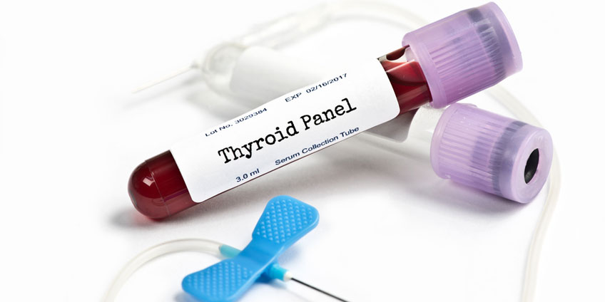 11 Labs Your Doctor Should Order to Ensure Optimal Thyroid Health