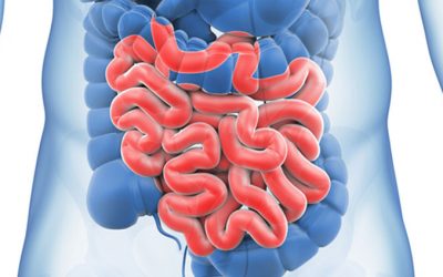 Irritable Bowel Syndrome: A Name Not a Solution