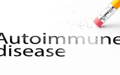 My Exact Formula to Preventing and Reversing Autoimmune Conditions