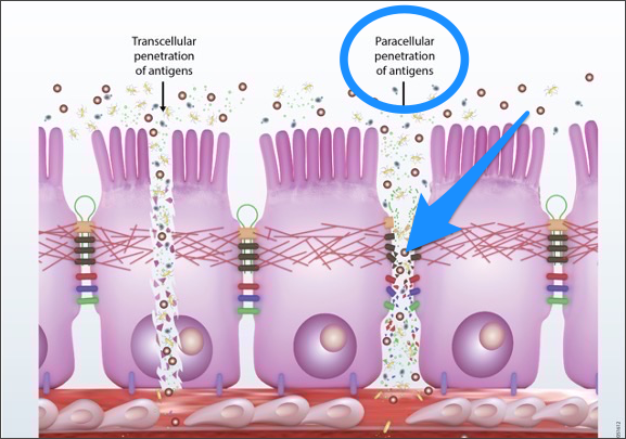 Paracellular Leaky Gut Damage