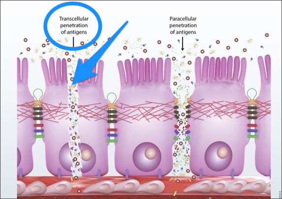 Transcellular Leaky Gut Damage