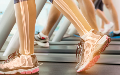 5 Bone-Health Mistakes You Might Be Making