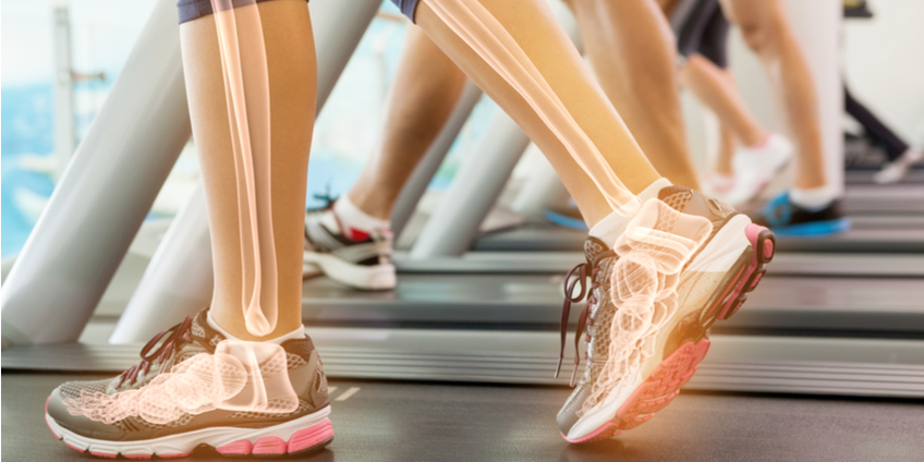 5 Bone-Health Mistakes You Might Be Making