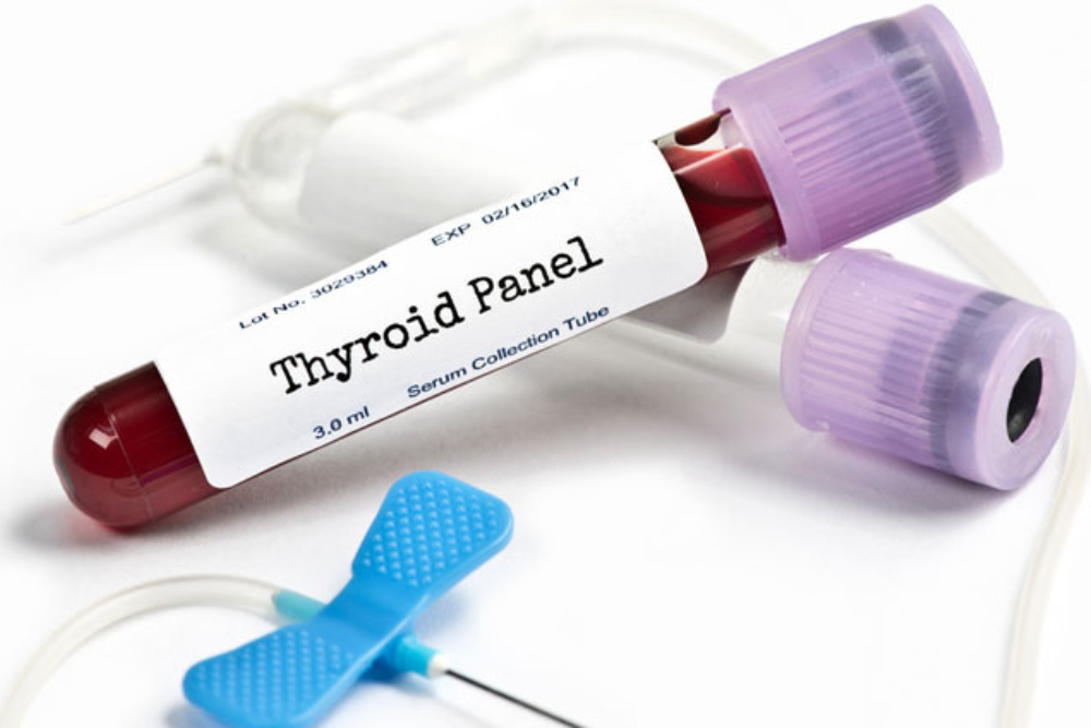 11 Labs Your Doctor Should Order to Ensure Optimal Thyroid Health